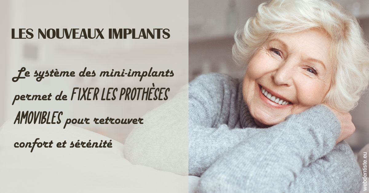 https://dr-sfedj-thierry.chirurgiens-dentistes.fr/Les nouveaux implants 1