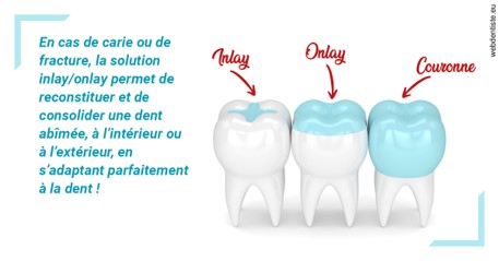 https://dr-sfedj-thierry.chirurgiens-dentistes.fr/L'INLAY ou l'ONLAY