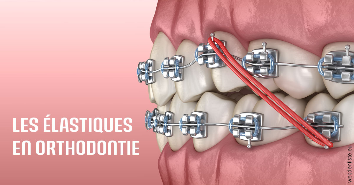 https://dr-sfedj-thierry.chirurgiens-dentistes.fr/Elastiques orthodontie 2